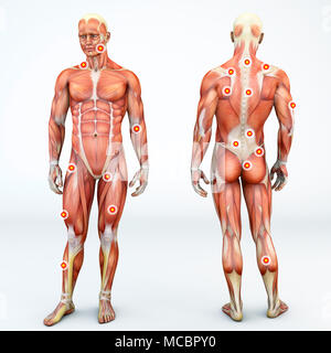 Vues avant et arrière d'un homme et de points de déclenchement. Muscle anatomie homme. Le rendu 3d. Points myofascial trigger points hyperirritable Banque D'Images