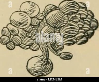 . Fig. 127. -Un racemose echino- coccus, grandeur nature. (Après Leuckart, 1880.) présenter le}' rarement produire suffisamment de perturbation à attirer l'attention. D'autre part, ^Yhen nombreuses elles déforment le foie, produire l'atrophie glandulaire, augmenter la taille totale de l'organe, et conduire à l'apparition de symptômes marqués clairement. Les vésicules kystiques contiennent un clair, limpide, transparent, liquide dans lequel flottent, secondaire, fille ou petite-fille des vésicules. Les symptômes. L'échinococcose du foie n'a pas bien signalé sj'mPTOM, et est donc difficile à diagnostiquer chez les animaux dont le foie est profondément se Banque D'Images