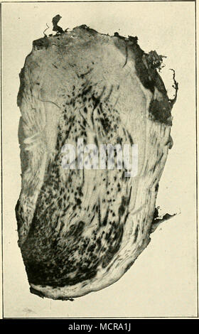 . Photo] Fig. 93 Agri., la Jamaïque La maladie de Panama : les jeunes à partir de la plante mère Sucker infestés par le cou Banque D'Images