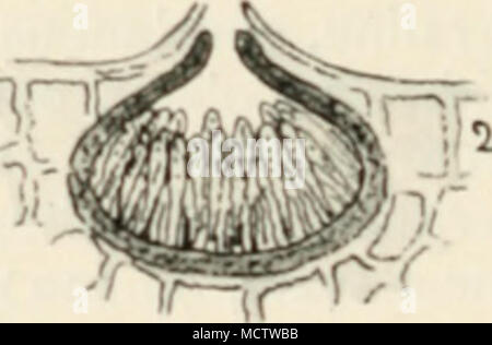 . Le FlC. 63. - Je, Sphacrulina taxi, yew lc;si, légèrement mag.  ; 2, section d'pcrithecium légèrement. mag.  ; 3, contenant des spores des asques, hautement mag.  ; 4, les ascospores, hautement mag. Si la maladie s'attaque d'un arbre pour deux ou trois années de suite il est généralement tués. Heureusement, ce n'est pas une maladie courante, ou en tout cas il n'est pas très fréquemment enregistrées. Je l'ai vu au travail à Cornwall, et aussi dans le Yorkshire, où un certain nombre de beaux arbres d'if dans un cimetière sont tués. M. F. Moore de Glasnevin m'a informé qu'il avait remarqué la maladie dans trois comtés Banque D'Images