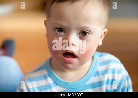 Portrait of cute baby boy avec le syndrome de