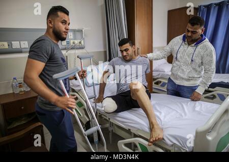 La bande de Gaza. 18 avr, 2018. Jeune homme palestinienne Alaa Dally (C) est visible à l'intérieur de l'hôpital al Quds, dans la ville de Gaza, le 18 avril 2018. Dally a été blessé par une balle explosive au cours de la manifestation anti-Israël sur la frontière Gaza-Israel. La zone limite entre l'est de Gaza et Israël a été témoin d'une série d'actions violentes et de sécurité les tensions, principalement depuis les six semaines des rassemblements et des marches organisées dans l'enclave côtière en Mars 30 et se poursuivra jusqu'au 15 mai. Credit : Wissam Nassar/Xinhua/Alamy Live News Banque D'Images