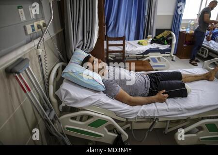 La bande de Gaza. 18 avr, 2018. Jeune homme palestinienne Alaa Dally est visible à l'intérieur de l'hôpital al Quds, dans la ville de Gaza, le 18 avril 2018. Dally a été blessé par une balle explosive au cours de la manifestation anti-Israël sur la frontière Gaza-Israel. La zone limite entre l'est de Gaza et Israël a été témoin d'une série d'actions violentes et de sécurité les tensions, principalement depuis les six semaines des rassemblements et des marches organisées dans l'enclave côtière en Mars 30 et se poursuivra jusqu'au 15 mai. Credit : Wissam Nassar/Xinhua/Alamy Live News Banque D'Images