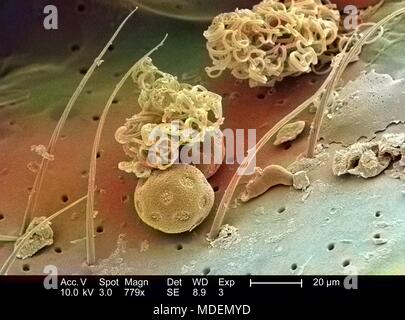 Débris microscopiques attachés à la surface de l'exosquelette d'un insecte non identifié a révélé dans le 779x au microscope électronique à balayage grossie (SEM) de droit, 2005. Image courtoisie Centres for Disease Control (CDC) / Janice Haney Carr. Remarque : l'image a été colorisée numériquement à l'aide d'un processus moderne. Les couleurs peuvent ne pas être scientifiquement exact. () Banque D'Images