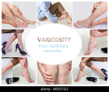 Collage sur femme en hauts talons en massant son jambes fatiguées Banque D'Images