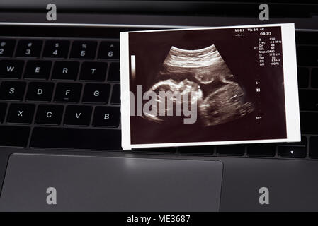 Photo d'échographie de bébé s'étendit sur le clavier d'ordinateur portable Banque D'Images