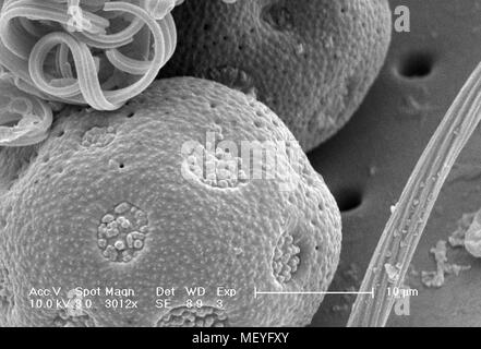 Débris microscopiques attachés à la surface de l'exosquelette d'un insecte non identifié a révélé dans le 2994x amplifiés en microscopie électronique à balayage (MEB) de droit, 2005. Image courtoisie Centres for Disease Control (CDC) / Janice Haney Carr. () Banque D'Images