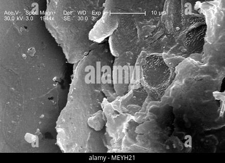 Caractéristiques morphologiques du chat domestique (Felis domesticus) griffe, révélé dans le 1944x amplifiés en microscopie électronique à balayage (MEB) de droit, 2005. Image courtoisie Centres for Disease Control (CDC) / Janice Haney Carr. () Banque D'Images