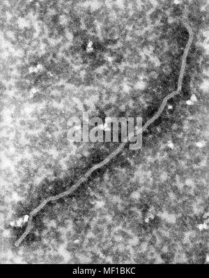 Détails de l'ultrastructure d'une nucléocapside du virus Nipah, révélé dans les 168.000x amplifiés par transmission (TEM) micrographiques de droit, 1999. Image courtoisie Centres for Disease Control (CDC) / C. S. Goldsmith, P. Rota. () Banque D'Images