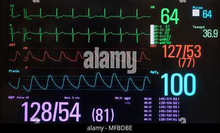 Un moniteur avec un fond noir montrant un ECG avec rythme sinusal normal en vert, la pression artérielle en rouge, la saturation en oxygène en bleu Banque D'Images