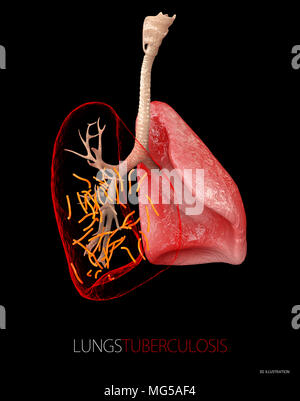 Bactérie Mycobacterium tuberculosis, l'agent étiologique de la tuberculose, 3D illustration. Banque D'Images