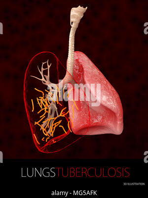 Bactérie Mycobacterium tuberculosis, l'agent étiologique de la tuberculose, 3D illustration. Banque D'Images