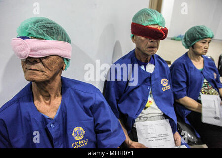 Medan, Nord de Sumatra, en Indonésie. 2 mai, 2018. Les patients attendent leur tour d'avoir la chirurgie de la cataracte, l'hôpital de Medan, Sumatra du nord le 1 mai 2018. Plus de 175 patients ont reçu gratuitement de la cataracte dans le cadre d'une campagne visant à améliorer la santé de l'œil des membres des communautés pauvres en Indonésie, qui a un des plus hauts taux de cécité dans le monde et aussi le plus élevé en Asie du sud-est. Crédit : Ivan Damanik/ZUMA/Alamy Fil Live News Banque D'Images