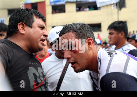 01 mai 2018, Lima, Pérou : un homme avec une blessure au visage par un comité permanent pour le terrain de soccer interlocutoire street soccer match 'Mundialito'. Pour la 60e fois, les passe-temps joueurs de football ont réalisé cette rue match dans la capitale de Lima au Pérou. Plusieurs fans encourageaient leurs équipes dans une rue peu recommandables dans le district de La Victoria. Les supporters de football payés jusqu'à 1 000 soles (255 euros) pour des sièges de loge aux fenêtres des maisons limitrophes. Photo : Geraldo Caso Bizama/dpa Banque D'Images