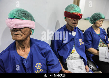 Medan, Nord de Sumatra, en Indonésie. 2 mai, 2018. Les patients attendent leur tour d'avoir la chirurgie de la cataracte, l'hôpital de Medan, au nord de Sumatra. Plus de 175 patients ont reçu gratuitement de la cataracte dans le cadre d'une campagne visant à améliorer la santé de l'œil des membres des communautés pauvres en Indonésie, qui a un des plus hauts taux de cécité dans le monde et aussi le plus élevé en Asie du sud-est. Crédit : Ivan Damanik/ZUMA/Alamy Fil Live News Banque D'Images