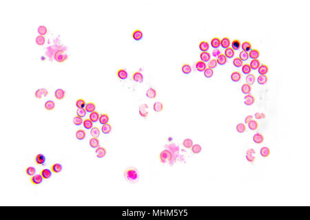 Photographie en microscopie électronique. Des œufs de Taenia solium. Banque D'Images