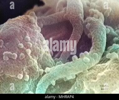 Présence du virus de l'immunodéficience humaine (VIH-1) dans un échantillon de tissu, a révélé le caractère fortement amplifiée en microscopie électronique à balayage (MEB) de droit, 1989. Image courtoisie Centres for Disease Control (CDC) / C. Goldsmith, P. Feorino, E. L. Palmer, W. R. McManus. Remarque : l'image a été colorisée numériquement à l'aide d'un processus moderne. Les couleurs peuvent ne pas être scientifiquement exact. () Banque D'Images