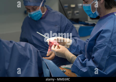 La chirurgie de l'endométriose Banque D'Images