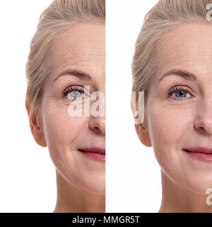Oman d'âge moyen visage avant et après intervention cosmétique. Concept de chirurgie plastique. Banque D'Images