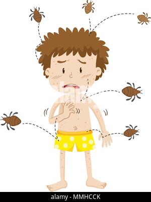 Un homme ayant une allergie Acariens illustration Illustration de Vecteur