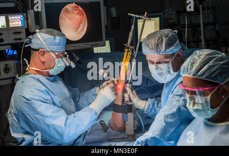 Lieutenant-colonel Dana Hess (à gauche), un chirurgien dans le 60e Escadron d'opérations chirurgicales, David Grant Medical Center de l'US Air Force, procède à une arthroscopie résection cubitus droit sur un patient, le 31 août 2017, Travis Air Force Base, Californie chargé d'aider Hess au cours de l'opération, le personnel. Le Sgt. Scot Butler (centre) et les aviateurs Alyssa Avelino (à droite), 60 spécialistes des services chirurgicaux, SGCS, s'assurer que la procédure va aussi bien que possible.(U.S. Air Force photo/ Heide Table) Banque D'Images