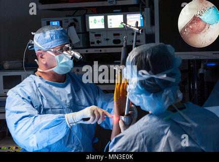 Lieutenant-colonel Dana Hess (à gauche), un chirurgien dans le 60e Escadron d'opérations chirurgicales, David Grant Medical Center de l'US Air Force, procède à une arthroscopie résection cubitus droit sur un patient, le 31 août 2017, Travis Air Force Base, Californie chargé d'aider Hess au cours de l'opération, le personnel. Le Sgt. Scot Butler (à droite), 60 SGCS, un spécialiste du service de chirurgie, s'assure que la procédure va aussi bien que possible. (U.S. Air Force photo/ Heide Table) Banque D'Images