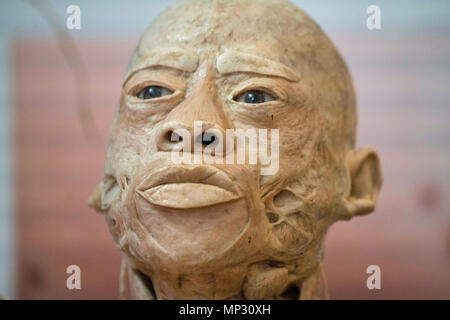 Anatomie d'une vraie tête humaine Banque D'Images
