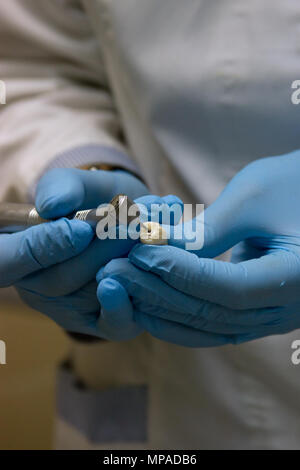 Chirurgien-dentiste dents prothétiques de moulage à l'aide d'une fraise dentaire et burr Banque D'Images