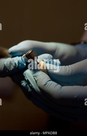 Chirurgien-dentiste dents prothétiques de moulage à l'aide d'une fraise dentaire et burr Banque D'Images