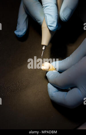 Chirurgien-dentiste dents prothétiques de moulage à l'aide d'une fraise dentaire et burr Banque D'Images