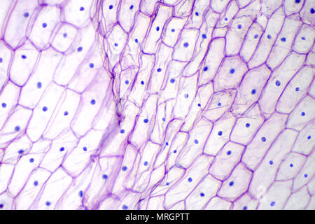 L'épiderme d'oignon sous microscope optique. De couleur pourpre, de grandes cellules épidermiques d'un oignon, Allium cepa, en une seule couche. Photo. Banque D'Images