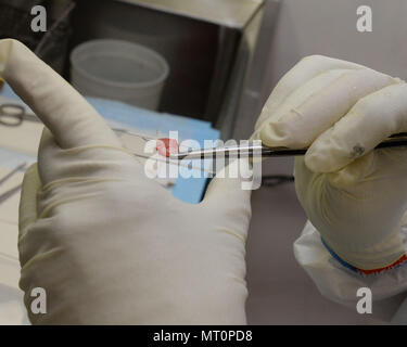 Le Major de l'US Air Force (Dr.) Luisa Watts, 88e Escadron de diagnostics et thérapeutiques, pathologiste examine une excision de la peau avec un carcinome baso-cellulaire pour consultation intraoperative (c.-à-surgelé) à Wright-Patterson Air Force Base Medical Center, le 26 juin 2017. En définitive, le tissu sera placée sur une lame de verre pour l'examen microscopique par laquelle la Dre Watts fera un diagnostic peropératoire qui déterminera ce type de chirurgie le patient reçoit. Cette consultation se fait alors que le patient est anesthésié à l'OR. Les pathologistes ont 20 minutes pour rendre un Banque D'Images