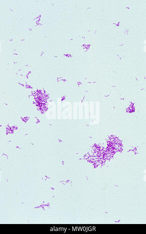 Clostridium tetani.Bactery de TetaniGram Banque D'Images