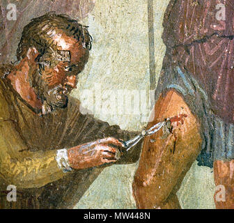 . Italiano : Museo Archeologico Nazionale di Napoli (inv. n° 8. 9009). Da Pompéi, Casa di Sirico - Enea ferito, en moto, viene dal medico Japix curato (amministrazione), mentre Venere, preoccupata, giunge portando erbe medicamentose ; intanto il figlio Ascanio, dans lacrime, è presso il padre. Anglais : le médecin Iapyx tente de déposer une tête de la flèches cuisses d'Enée à l'aide d'un forceps (Virgile Enéide XII.383-440) fresque romaine à partir de la Casa di Sirico (VII 1, 25.47) à Pompéi. Deutsch : Der Arzt Iapyx mit einer Zange versucht eine Pfeilspitze aus dem Schenkel des Enée zu supprimer (Vergil Aene Banque D'Images