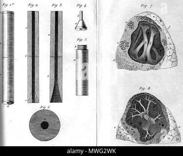 . René Théophile Hyacinthe Laennec (1781-1825) : De l'auscultation médiate, 1819. Janvier 2008. 357 McLeod stéthoscope Laennec poumons Banque D'Images