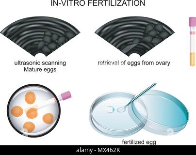 L'illustration de la technologie de la FIV, l'échographie. vector Illustration de Vecteur
