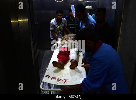 Srinagar, Inde. 04 Juin, 2018. (NOTE DU RÉDACTEUR : Image contient contenu graphique.)Une femme blessée arrive à un hôpital de Srinagar, Cachemire indien le 4 juin 2018. 12 civils et quatre policiers ont été blessés après avoir jeté des suspects rebelles grenade dans le district de Shopian du Cachemire. Credit : Muzamil Mattoo/Pacific Press/Alamy Live News Banque D'Images