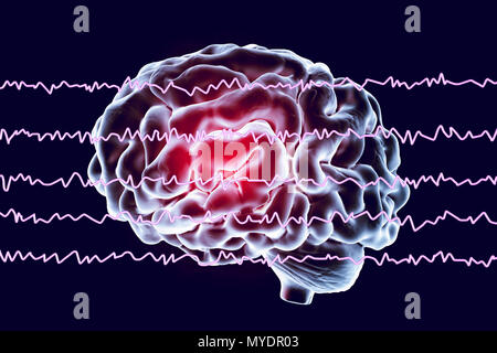 Cerveau et active les ondes cérébrales, illustration de l'ordinateur. Un électroencéphalogramme (EEG) mesure l'activité électrique dans le cerveau à l'aide d'électrodes fixées sur le cuir chevelu. Divers troubles peuvent être diagnostiquées par l'analyse des résultats de l'EEG. Banque D'Images