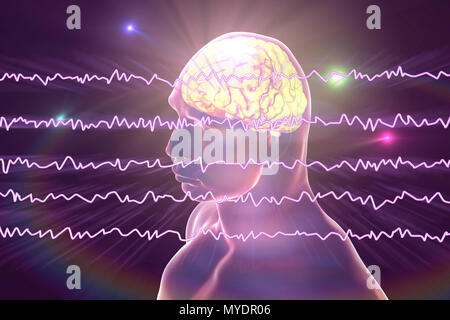 Cerveau et active les ondes cérébrales, illustration de l'ordinateur. Un électroencéphalogramme (EEG) mesure l'activité électrique dans le cerveau à l'aide d'électrodes fixées sur le cuir chevelu. Divers troubles peuvent être diagnostiquées par l'analyse des résultats de l'EEG. Banque D'Images