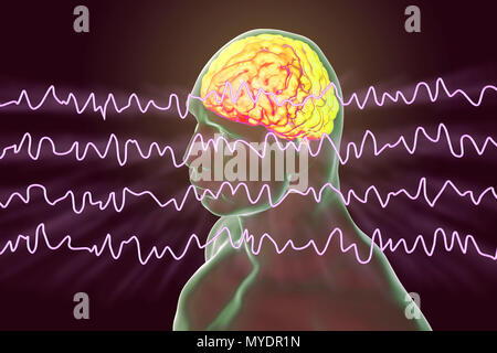 Cerveau et les ondes du cerveau en état de veille pendant le repos, l'illustration de l'ordinateur. Un électroencéphalogramme (EEG) mesure l'activité électrique dans le cerveau à l'aide d'électrodes fixées sur le cuir chevelu. Divers troubles peuvent être diagnostiquées par l'analyse des résultats de l'EEG. Banque D'Images