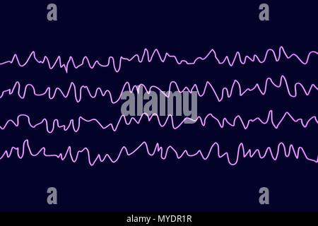 Les ondes cérébrales en état de veille pendant le repos, l'illustration de l'ordinateur. Un électroencéphalogramme (EEG) mesure l'activité électrique dans le cerveau à l'aide d'électrodes fixées sur le cuir chevelu. Divers troubles peuvent être diagnostiquées par l'analyse des résultats de l'EEG. Banque D'Images