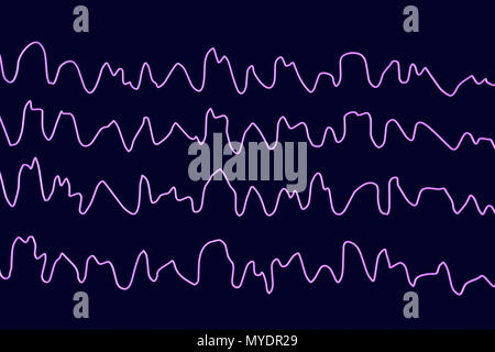 Les ondes du cerveau pendant le sommeil, l'illustration de l'ordinateur. Un électroencéphalogramme (EEG) mesure l'activité électrique dans le cerveau à l'aide d'électrodes fixées sur le cuir chevelu. Divers troubles peuvent être diagnostiquées par l'analyse des résultats de l'EEG. Banque D'Images