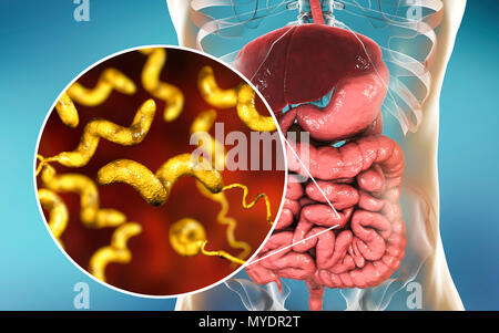 La campylobactériose, illustration conceptuelle. Campylobacter jejuni est un mobile, bactérie à Gram négatif avec une longue flagelles à une extrémité qui est utilisé pour la locomotion. Il peut croître dans des environnements où peu d'oxygène. C'est une cause commune de la gastro-entérite chez les humains, surtout les enfants et les jeunes adultes. Volailles contaminés, la viande et le lait sont des sources d'infection. Les symptômes comprennent la fièvre et douleur abdominale aiguë, suivie d'eau et souvent une diarrhée sanglante. La récupération est généralement rapide. Banque D'Images