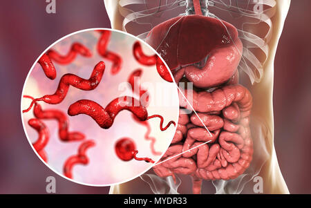 La campylobactériose, illustration conceptuelle. Campylobacter jejuni est un mobile, bactérie à Gram négatif avec une longue flagelles à une extrémité qui est utilisé pour la locomotion. Il peut croître dans des environnements où peu d'oxygène. C'est une cause commune de la gastro-entérite chez les humains, surtout les enfants et les jeunes adultes. Volailles contaminés, la viande et le lait sont des sources d'infection. Les symptômes comprennent la fièvre et douleur abdominale aiguë, suivie d'eau et souvent une diarrhée sanglante. La récupération est généralement rapide. Banque D'Images