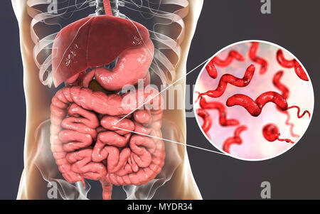 La campylobactériose, illustration conceptuelle. Campylobacter jejuni est un mobile, bactérie à Gram négatif avec une longue flagelles à une extrémité qui est utilisé pour la locomotion. Il peut croître dans des environnements où peu d'oxygène. C'est une cause commune de la gastro-entérite chez les humains, surtout les enfants et les jeunes adultes. Volailles contaminés, la viande et le lait sont des sources d'infection. Les symptômes comprennent la fièvre et douleur abdominale aiguë, suivie d'eau et souvent une diarrhée sanglante. La récupération est généralement rapide. Banque D'Images