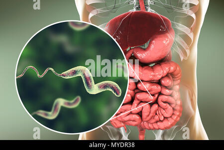 La campylobactériose, illustration conceptuelle. Campylobacter jejuni est un mobile, bactérie à Gram négatif avec une longue flagelles à une extrémité qui est utilisé pour la locomotion. Il peut croître dans des environnements où peu d'oxygène. C'est une cause commune de la gastro-entérite chez les humains, surtout les enfants et les jeunes adultes. Volailles contaminés, la viande et le lait sont des sources d'infection. Les symptômes comprennent la fièvre et douleur abdominale aiguë, suivie d'eau et souvent une diarrhée sanglante. La récupération est généralement rapide. Banque D'Images