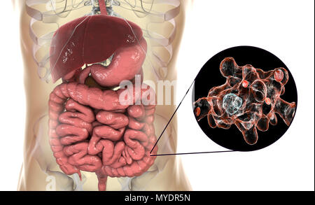 Amibe parasitaire (Entamoeba histolytica) dans le gros intestin, l'illustration de l'ordinateur. Cet organisme unicellulaire la dysenterie amibienne et ulcères (stade végétatif) trophozoïte. Il se transmet par contamination fécale des aliments et de l'eau et est plus commun où l'assainissement est pauvre. Les amibes envahissent l'intestin mais peut se répandre sur le foie, les poumons et d'autres tissus. L'infection est provoquée par l'ingestion de kystes qui se développent dans l'amibe trophozoïte pathogènes vus ici. Entamoeba histolytica est présente dans le monde entier, avec jusqu'à 50 % de la population infectée, principalement dans les climats chauds. Banque D'Images