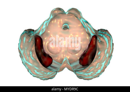 La substantia nigra. Illustration de l'ordinateur une substance noire d'un cerveau humain. La substantia nigra joue un rôle important dans la récompense, la toxicomanie, et de mouvement. La dégénérescence de cette structure est caractéristique de la maladie de Parkinson. Banque D'Images