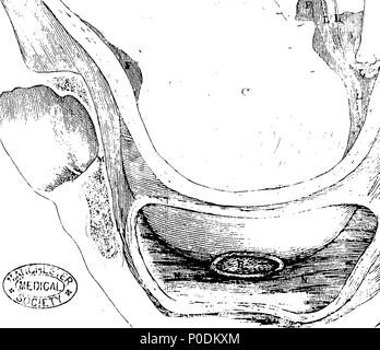 . Anglais : fleuron de livre : un système de tables, avec des explications ; représentant les fondements de la théorie et de la pratique de sage-femme. Par John Aitken, M. D. Membre du Collège royal des chirurgiens du Canada, membre de la Royal Medical, physiques, et les sociétés antiques, l'un des chirurgiens de la Royal Infirmary, Chargé de cours sur l'anatomie, de chirurgie et de sage-femme, et président honoraire de la société Chirurco-Obstetrical d'Édimbourg. À l'usage des étudiants. 218 Un système de tables, avec des explications ; représentant les fondements de la théorie et de la pratique de sage-femme Fleuron N Banque D'Images