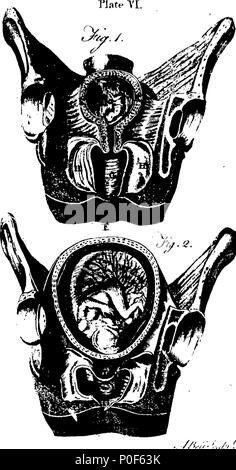. Anglais : fleuron de livre : un traité sur la théorie et la pratique de sage-femme. Par W. Smellie, M.D. Une nouvelle édition. À laquelle s'ajoute maintenant, sa série de tables anatomiques, présentant les différents cas qui se produisent dans la pratique, sur quarante cuivres gravées avec précision ; avec des explications. En trois volumes. ... 238 Un traité sur la théorie et de la pratique de sage-femme Fleuron N014178-2 Banque D'Images